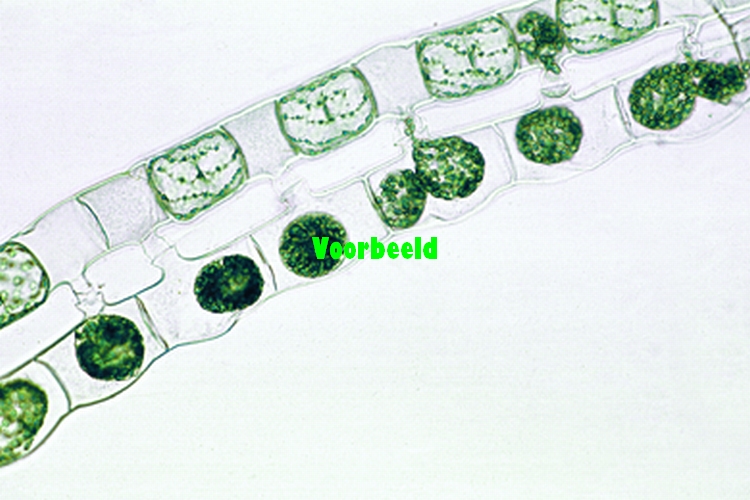 Spirogyra