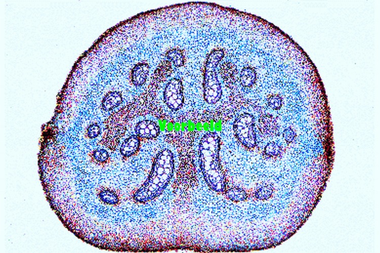 Pteridium