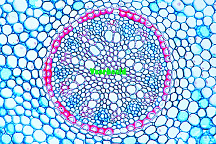 Concentric vascular bundles with outer x