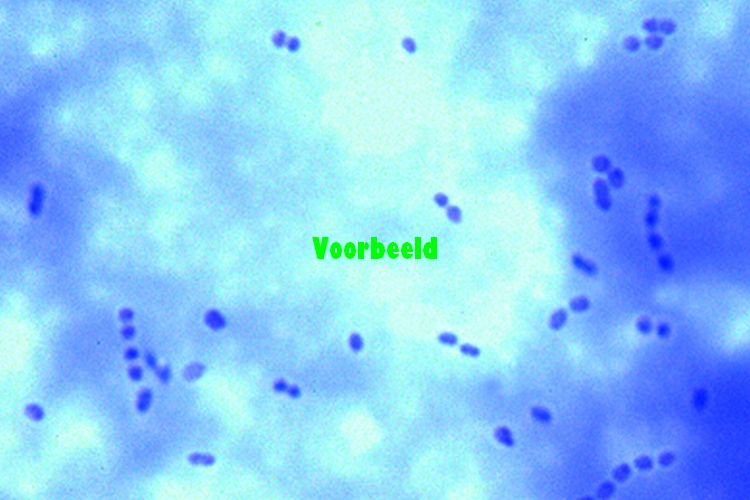 Streptococcus lactis