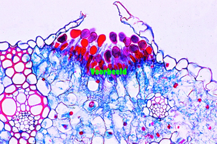 Puccinia graminis