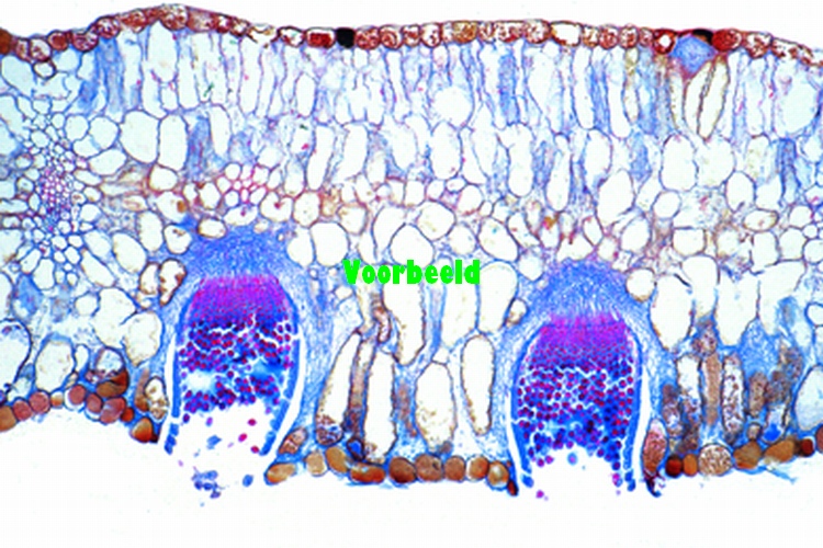 Puccinia graminis