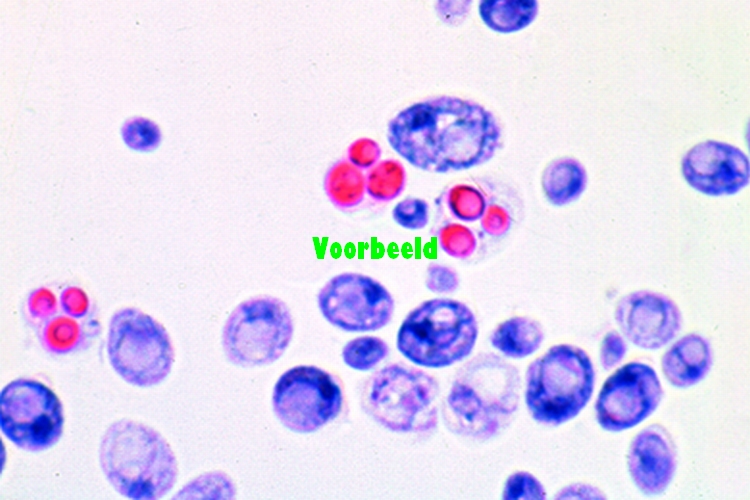Saccharomyces cerevisiae
