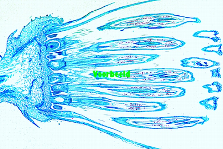 Taraxacum
