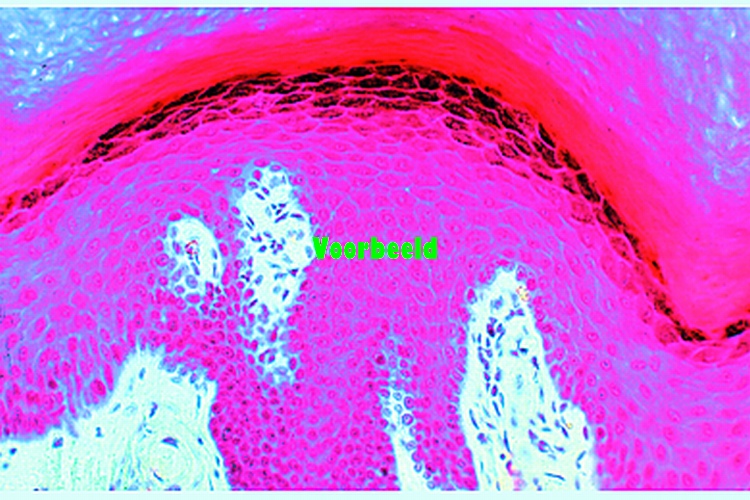 Skin, human, from general body surface s