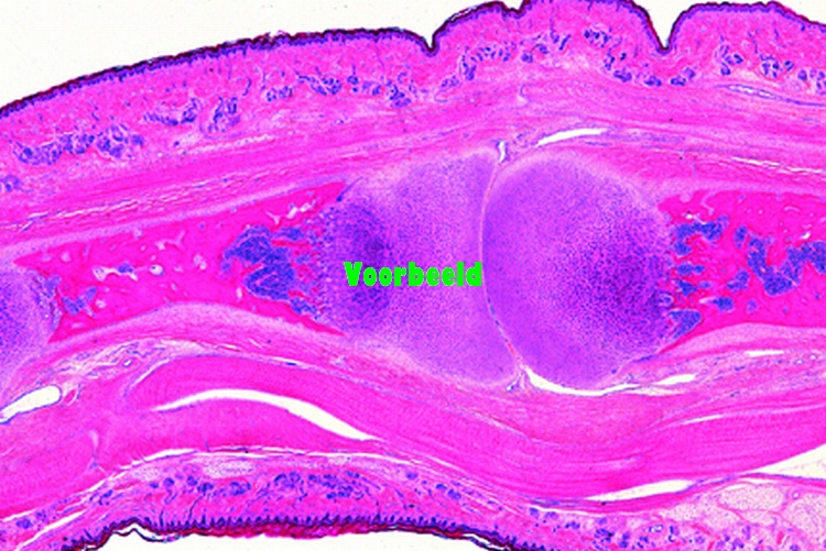 Developing cartilaginous bone, joint of