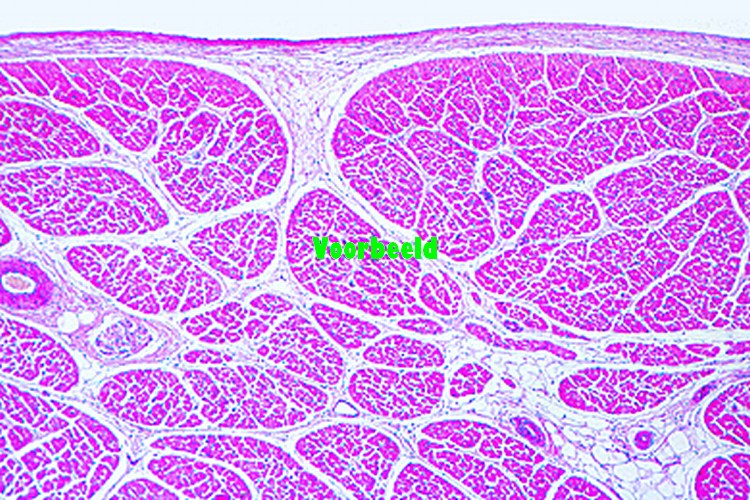 Striated muscle, human, t.s.