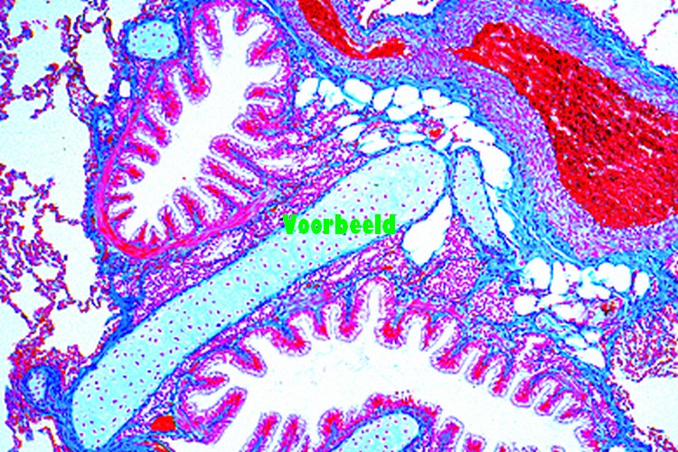 Lung, human t.s. showing alveoli, blood
