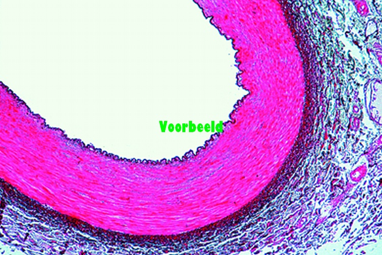 Aorta, human, t.s.