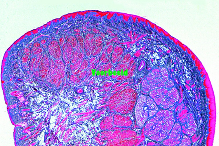 Lip, human foetus, t.s.