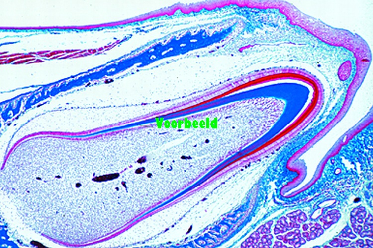 Tooth, developing, human foetus, l.s.
