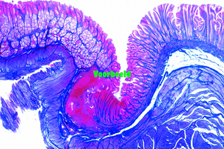 Stomach, human, pyloric region, t.s.