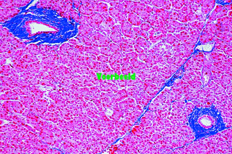 Pancreas, human, t.s.