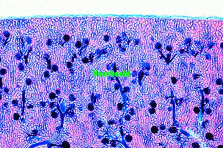 Kidney, pig, t.s. showing injected vesse