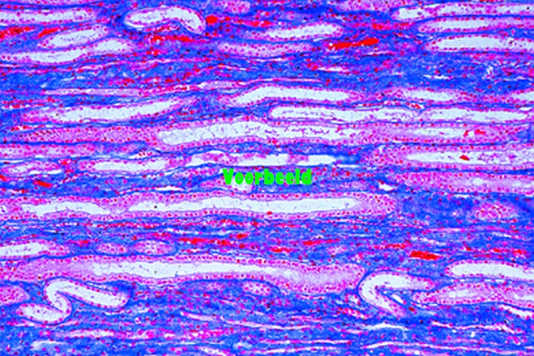 Kidney, rat, t.s. of the whole organ