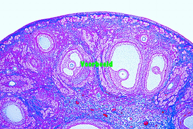 Ovary, rabbit, t.s.