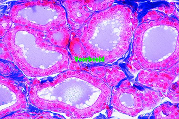 Thyroid gland, sheep, t.s.