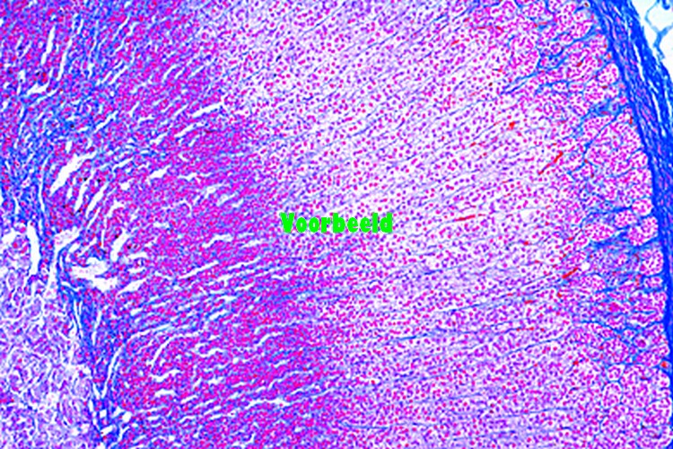 Adrenal gland, cat, t.s.