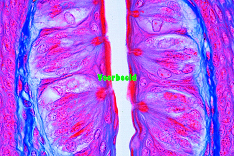 Tongue, rabbit, t.s., papillae with tast