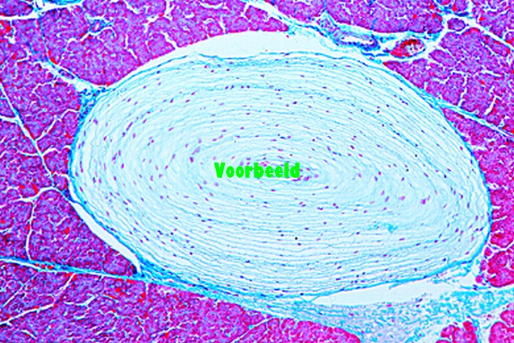 Touch corpuscles in human skin, t.s.