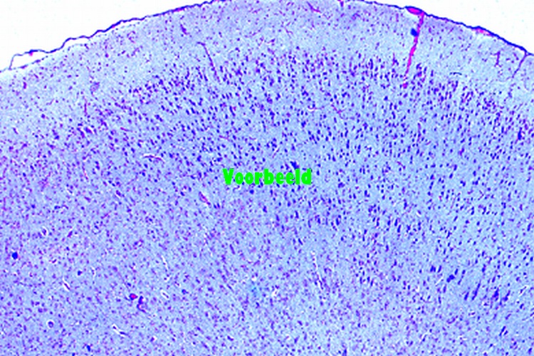 Cerebrum, human, cortex, t.s.