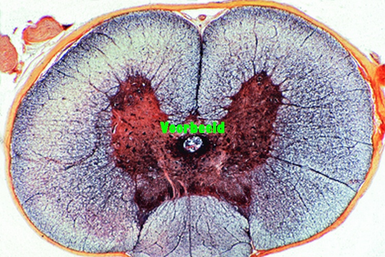 Spinal cord, cat, t.s., Klüver-Barrera s