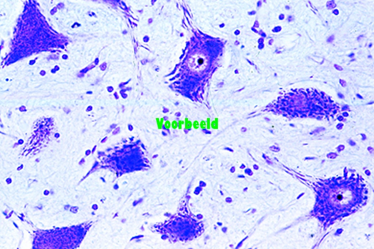 Spinal cord, cow, t.s., Nissl stained