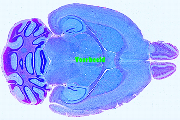 Brain, rat, median l.s.