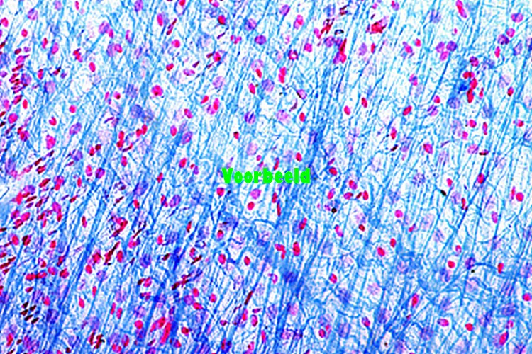 Connective tissue, human, sec.