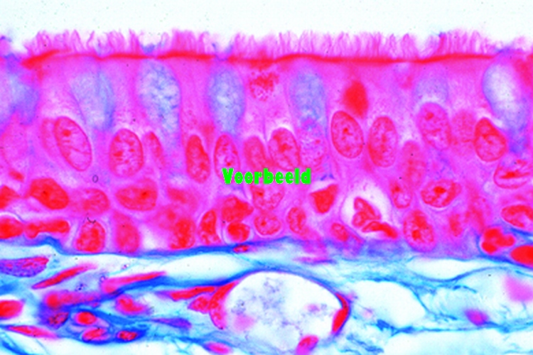 Ciliated epithelium, human trachea, t.s.