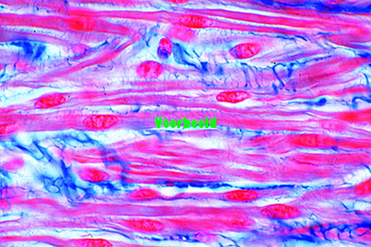 Smooth muscles, human, l.s. and t.s.