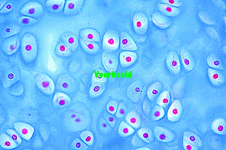 Hyaline cartilage, human, sec.