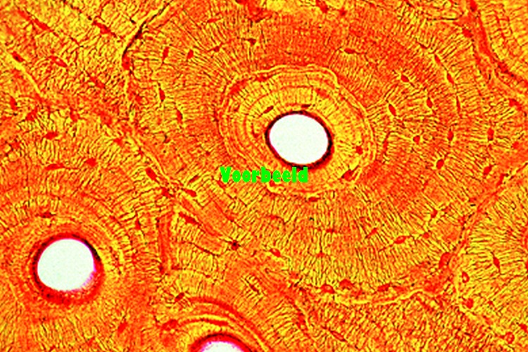 Bone, compact substance, human, t.s.
