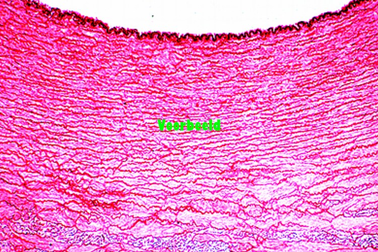Artery, human, t.s.
