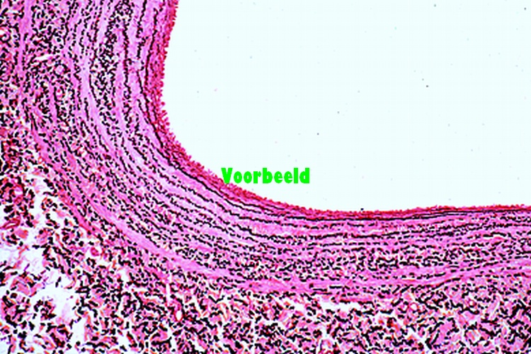 Vein, human, t.s.