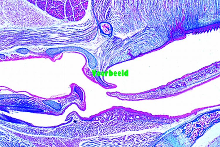 Larynx of human foetus, t.s.