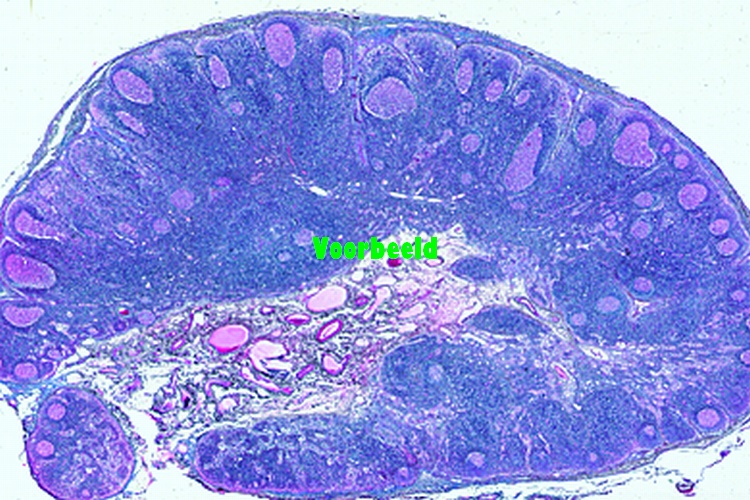 Lymph gland, human, t.s.