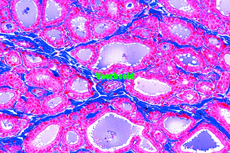 Thyroid gland, human, t.s.