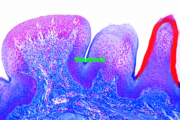 Tongue, human, t.s.