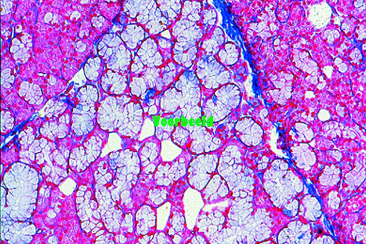 Sublingual gland, human, t.s.