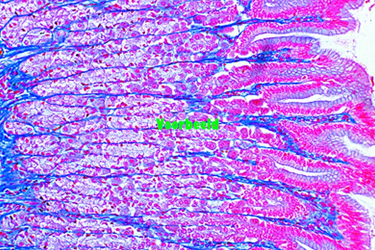 Stomach, pyloric region, human, t.s.