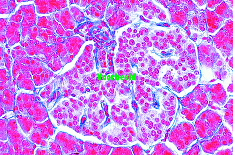 Pancreas, human, t.s.