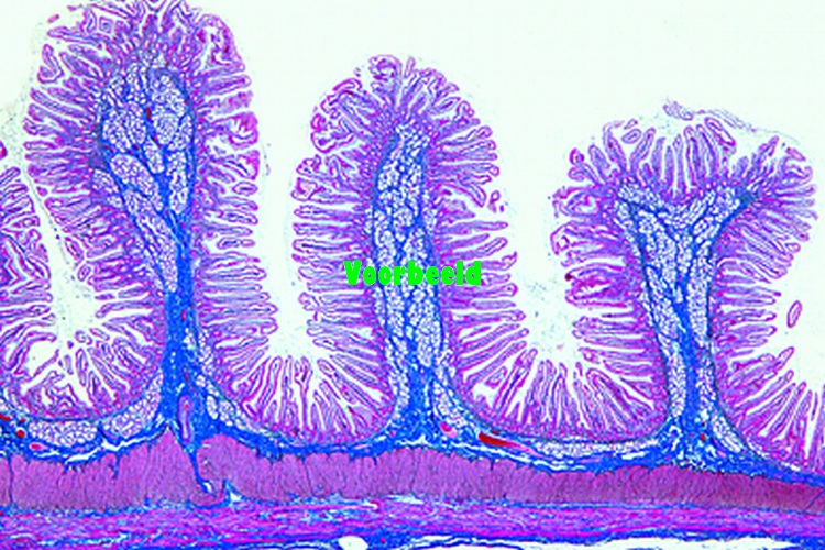 Small intestine, human, t.s.