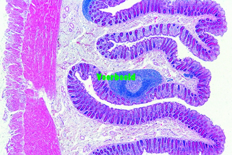 Large intestine, human, t.s.