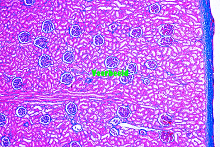 Kidney, human, t.s.