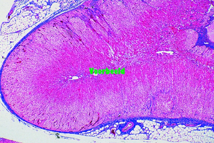 Adrenal gland, human, t.s.