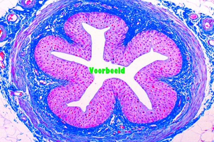 Ureter, human, t.s.