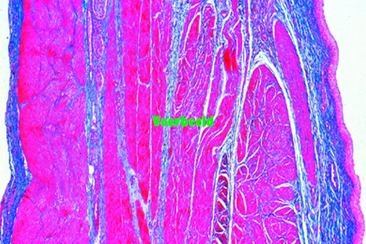 Urinary bladder, human, t.s.