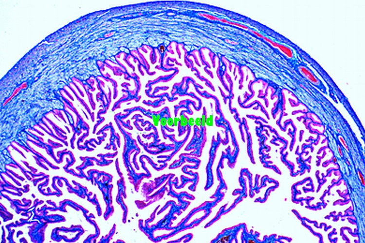 Uterine tube, human, t.s.