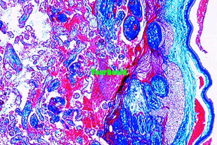 Placenta, human, t.s.